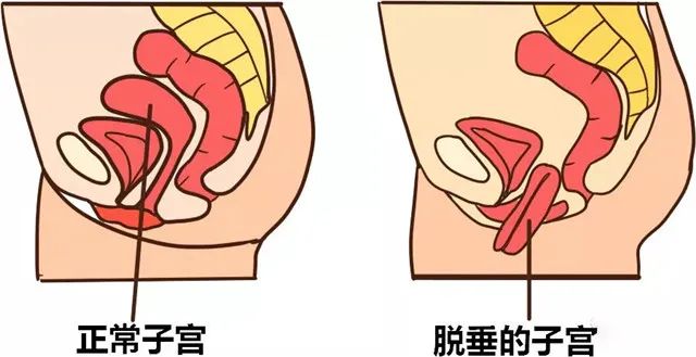 盆腔器官 盆腔器官