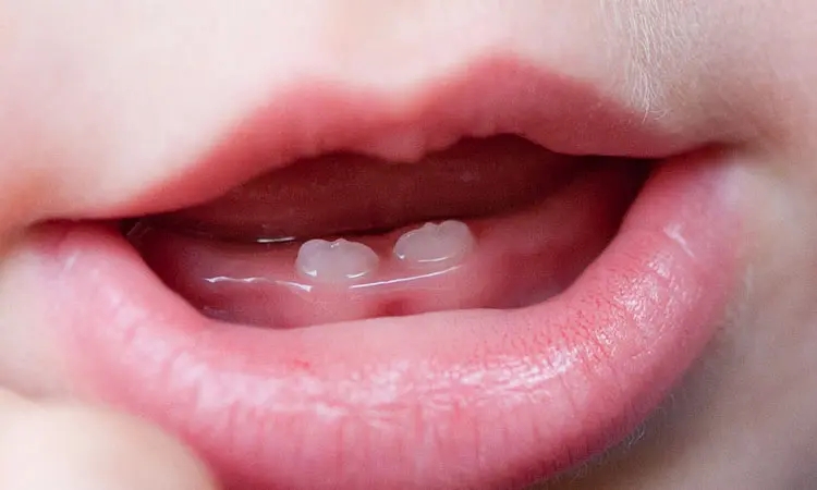 src=http___img.alicdn.com_imgextra_i1_2420813598_TB2twRJbbL9F1JjSZFuXXXoPpXa_!!2420813598-0-headline_editor.jpg&refer=http___img.alicdn.webp.jpg src=http___img.alicdn.com_imgextra_i1_2420813598_TB2twRJbbL9F1JjSZFuXXXoPpXa_!!2420813598-0-headline_editor.jpg&refer=http___img.alicdn.webp.jpg